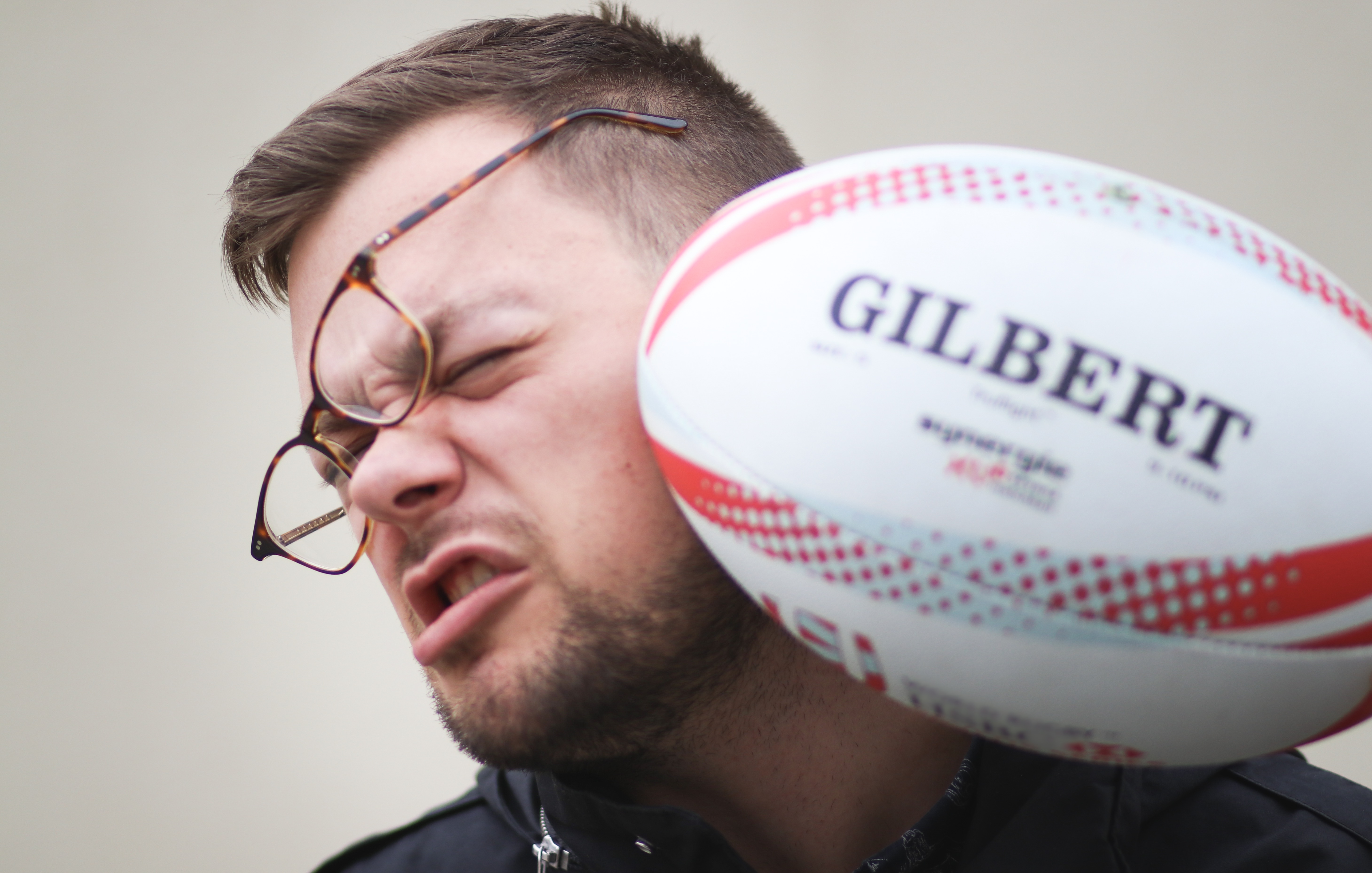 rugby ball to the face Young man hit in face with rugby ball