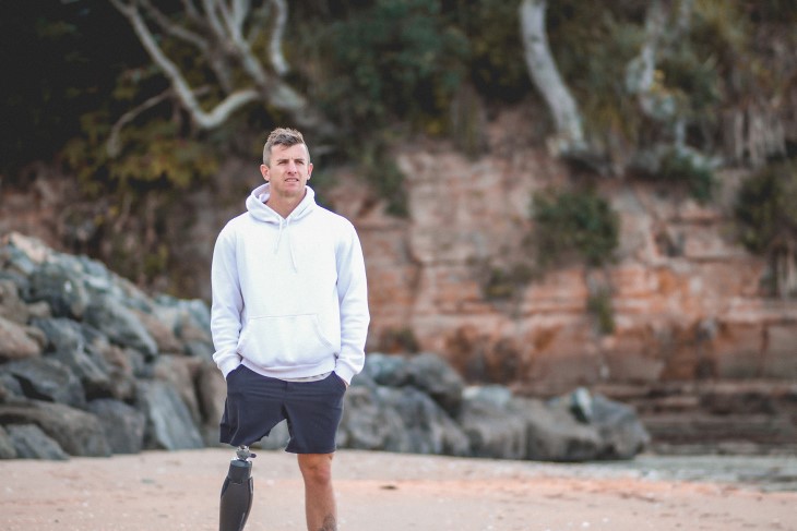 Corbin Hart stand on the beach wearing his prosthetic leg