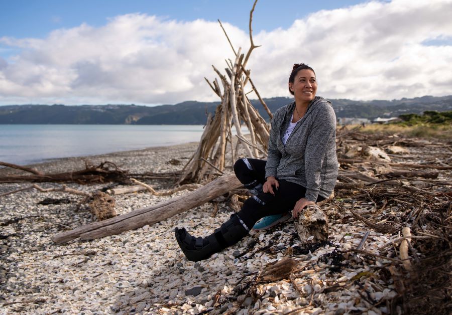 Woman with moonboot sitting on driftwood at beach